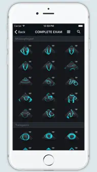 ECHO Views - Transesophageal Echocardiography iphone bilder 0