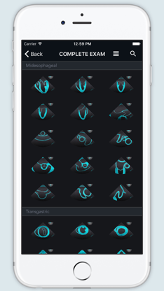 ECHO Views - Transesophageal Echocardiography screenshot 1