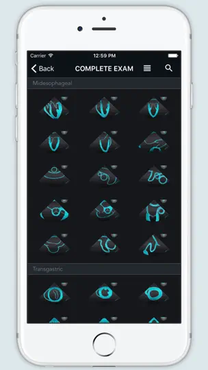 Capture d'écran de ECHO Views - Transesophageal Echocardiography sur iPhone 1