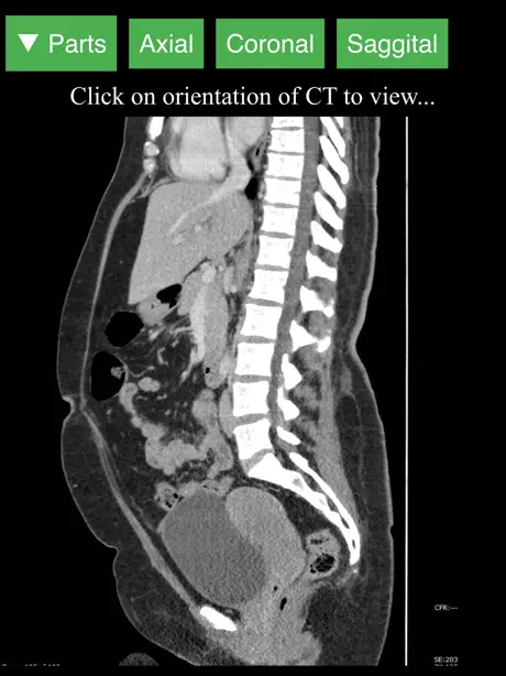 Radiology CT Viewer