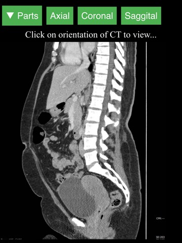 Radiology CT Viewerのおすすめ画像3