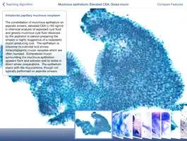 Game screenshot Johns Hopkins Atlas of Pancreatic Cytopathology hack
