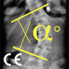 CobbMeter CE - Regis RIGAL