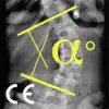 Similar CobbMeter CE Apps