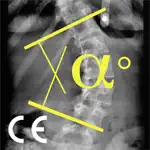 CobbMeter CE App Alternatives