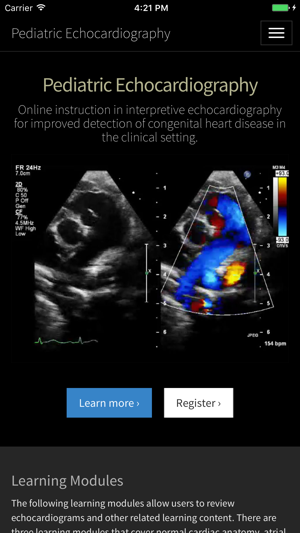 Pediatric Echocardiography(圖1)-速報App