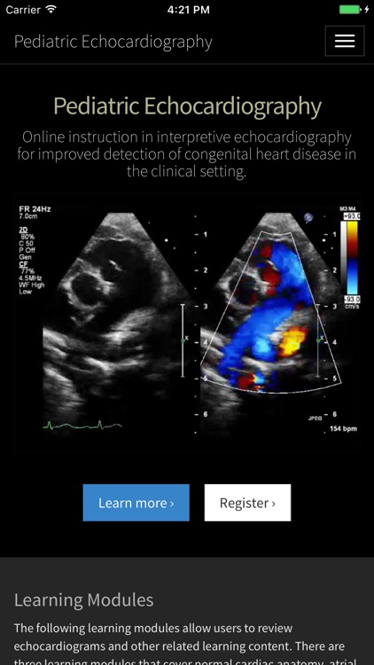 Pediatric Echocardiography