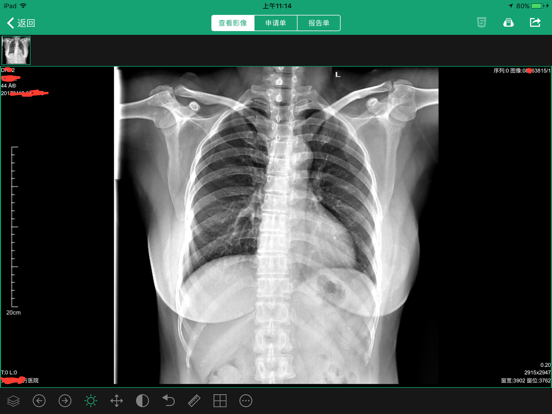 Screenshot #6 pour 易影HD-领先的“互联网+医学”影像云平台