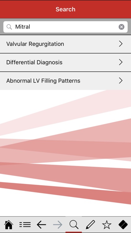 Echocardiography pocketcards