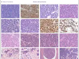 Game screenshot Johns Hopkins Atlas of Pancreatic Pathology apk