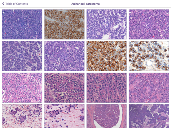 Johns Hopkins Atlas of Pancreatic Pathologyのおすすめ画像2