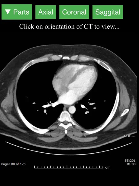 Radiology CT Viewer
