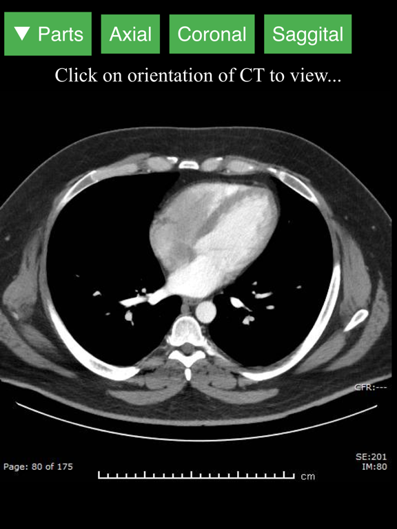 Radiology CT Viewerのおすすめ画像5