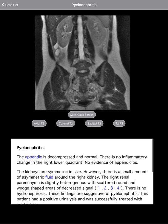 Radiology 2.0: Pregnant Appendicitis screenshot-4