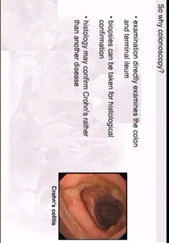 AnswersIn Crohn's Disease screenshot 3