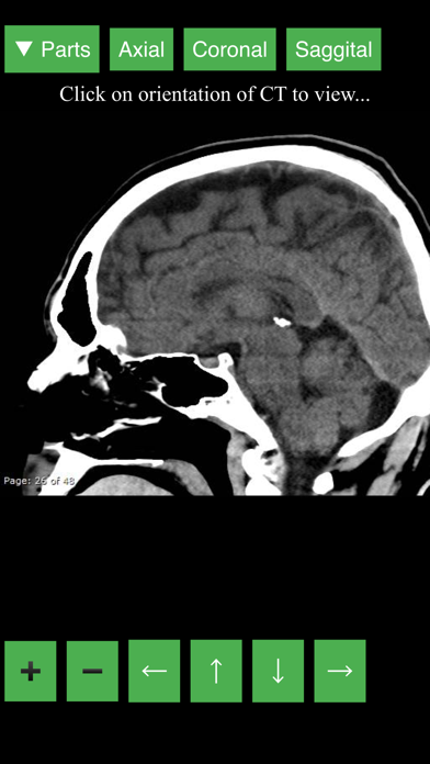 Radiology CT Viewer Screenshot