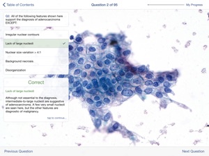 Johns Hopkins Atlas of Pancreatic Cytopathology screenshot #5 for iPad