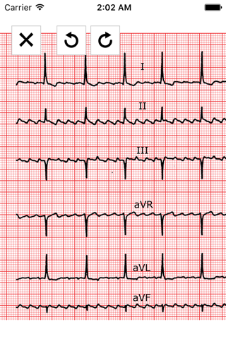 CARDIO-FR screenshot 3