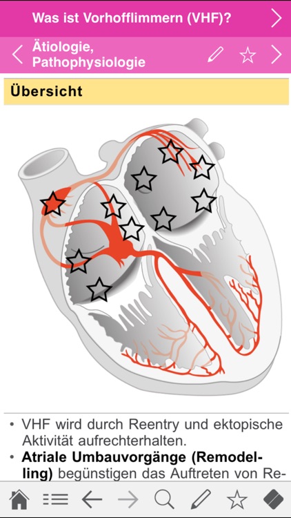 Vorhofflimmern infopocket