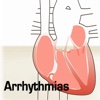 Arrhythmias Basic Guide-ECG Workout