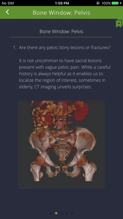 CT Abdomen screenshot-4