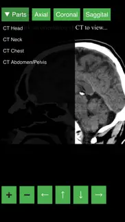 radiology ct viewer iphone screenshot 4