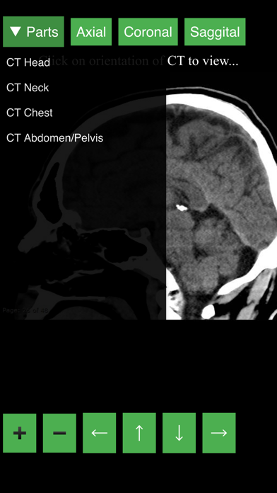 Radiology CT Viewer Screenshot