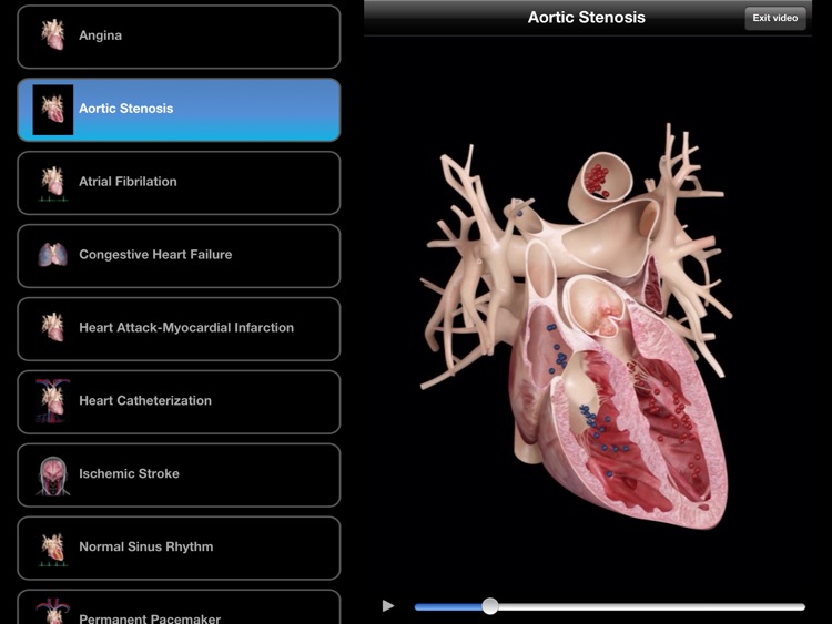 Cardiological
