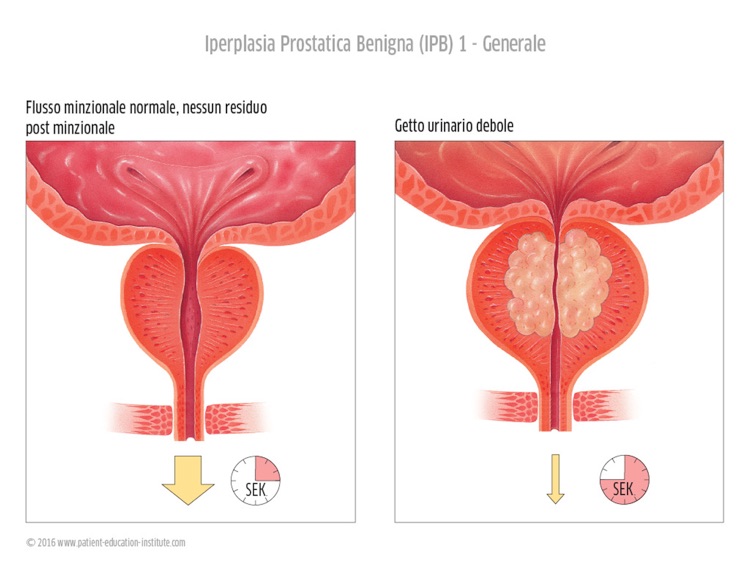 SIU, Urologia, tablet app screenshot-3