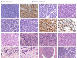 Johns Hopkins Atlas of Pancreatic Pathology screenshot #2 for iPad