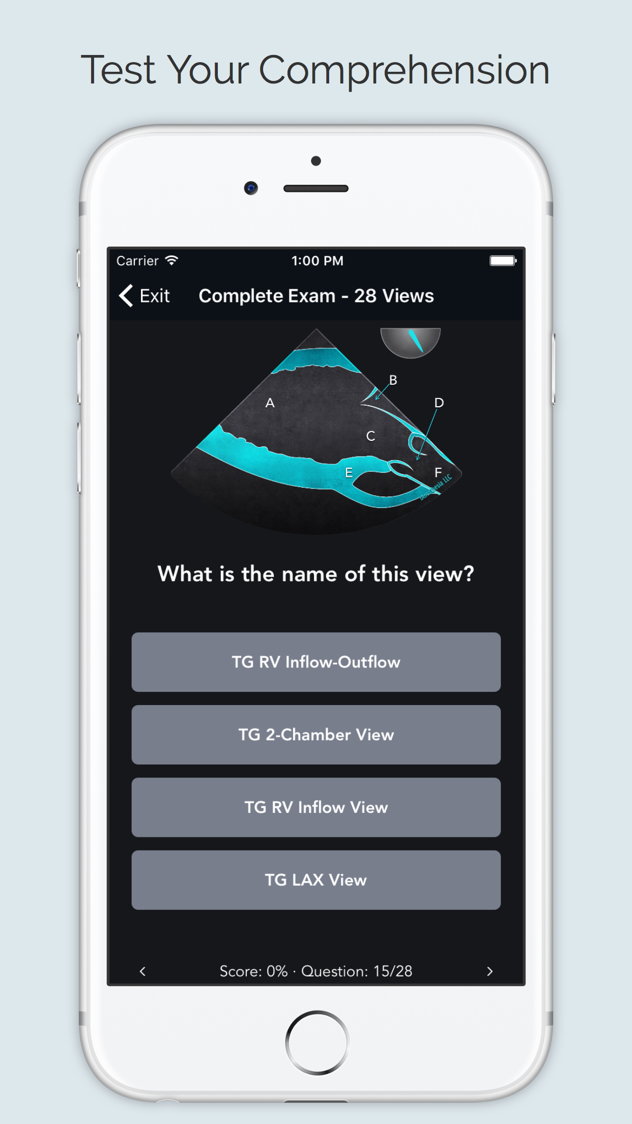 ECHO Views - Transesophageal Echocardiography