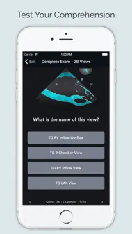 ECHO Views - Transesophageal Echocardiography iphone bilder 3