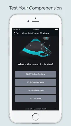 ECHO Views - Transesophageal Echocardiography iPhone image 4