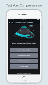 ECHO Views - Transesophageal Echocardiography screenshot