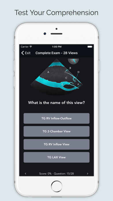 ECHO Views - Transesophageal Echocardiography Screenshot