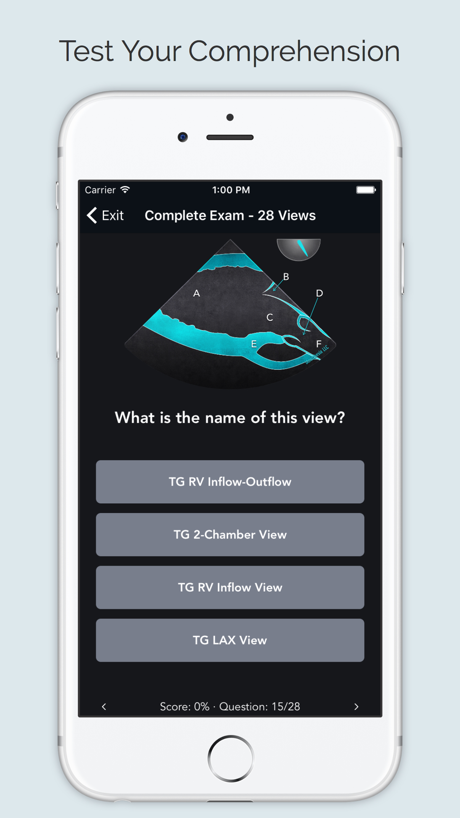 ECHO Views - Transesophageal Echocardiography App Store screenshot 4