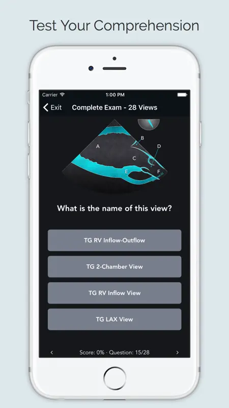ECHO Views - Transesophageal Echocardiography screenshot 4 of 5