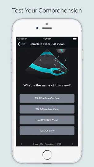 Capture d'écran de ECHO Views - Transesophageal Echocardiography sur iPhone 4