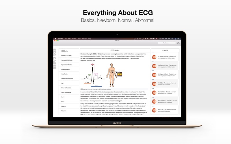 Screenshot #1 pour ECG PRO - for EMT