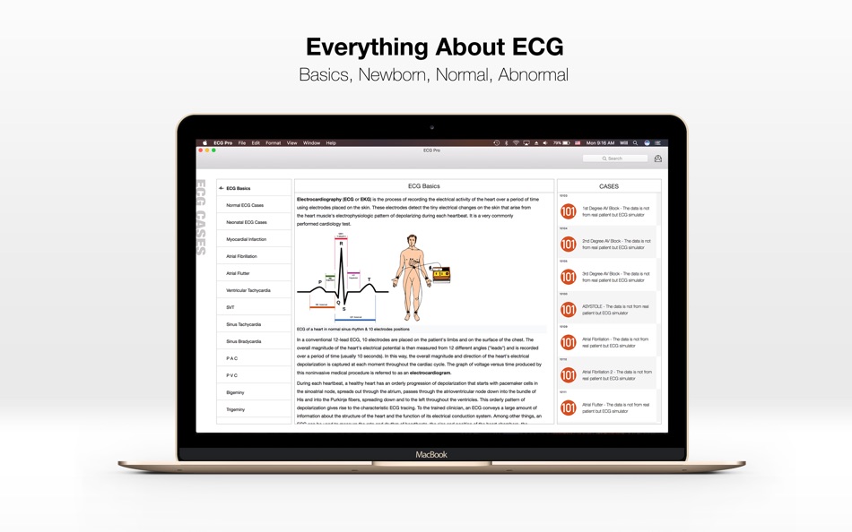 ECG PRO - for EMT - 2.2 - (macOS)