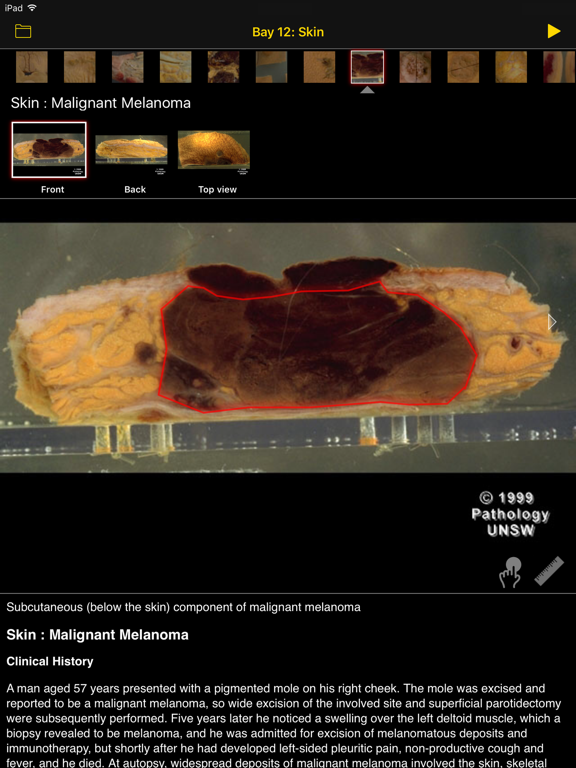 Screenshot #6 pour Images Of Disease
