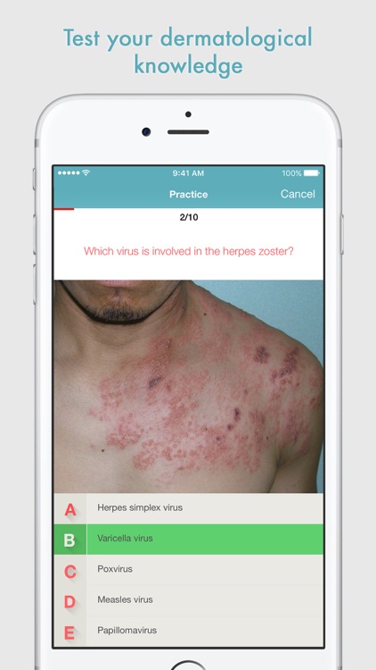 DermoMedia - Education in dermatology screenshot-4