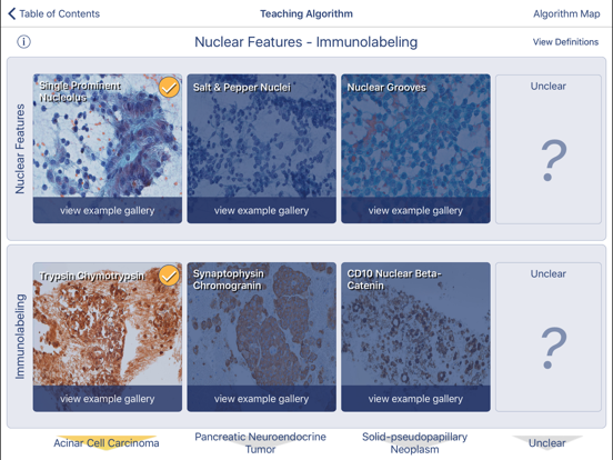 Johns Hopkins Atlas of Pancreatic Cytopathologyのおすすめ画像4