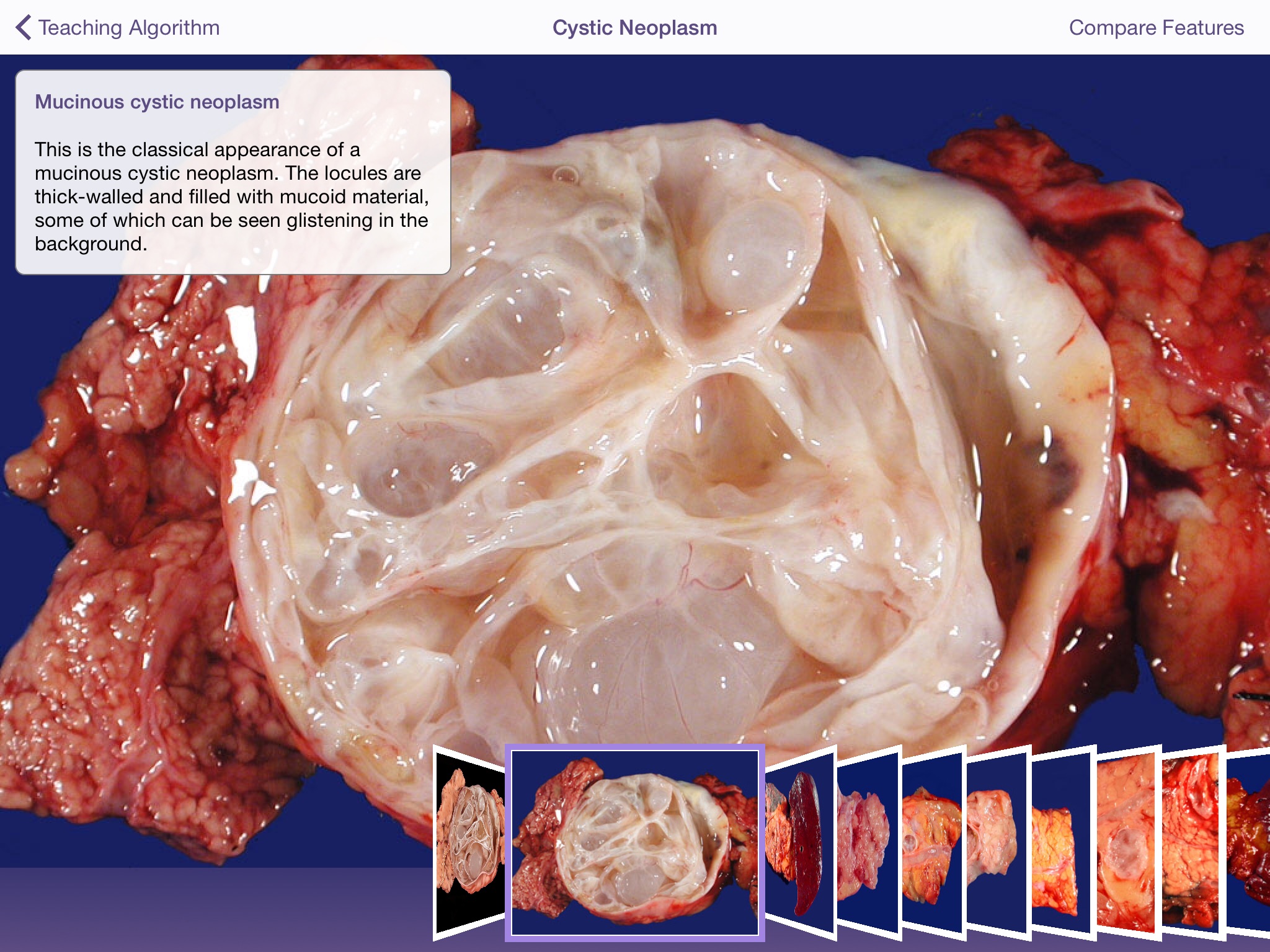 Johns Hopkins Atlas of Pancreatic Pathology screenshot 3