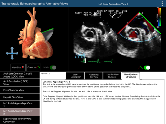 Screenshot #4 pour TEE Alternative Views