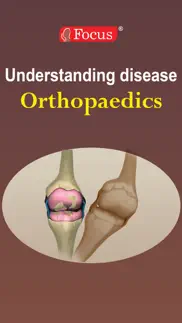 orthopaedics - understanding disease iphone screenshot 1