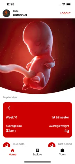 Game screenshot My Pregnancy Tracker mod apk