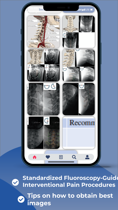 Interventional Pain App Screenshot