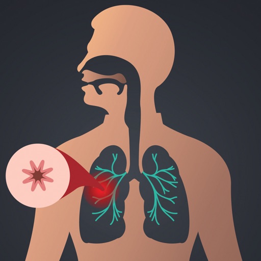 COPD Advances