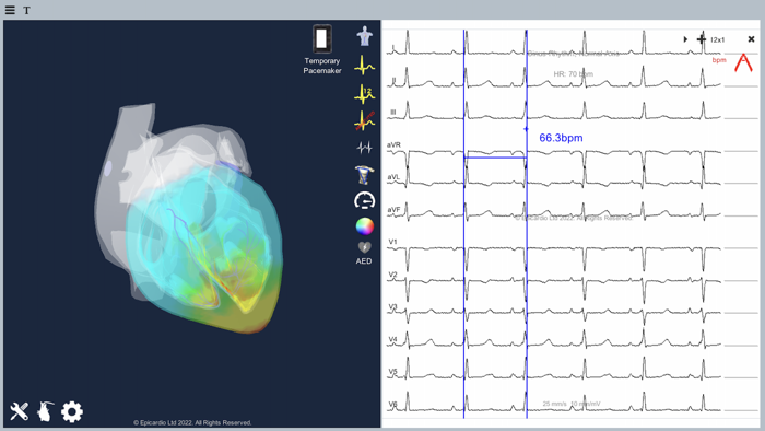 Epicardio Heart Simulator